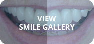 View smile gallery