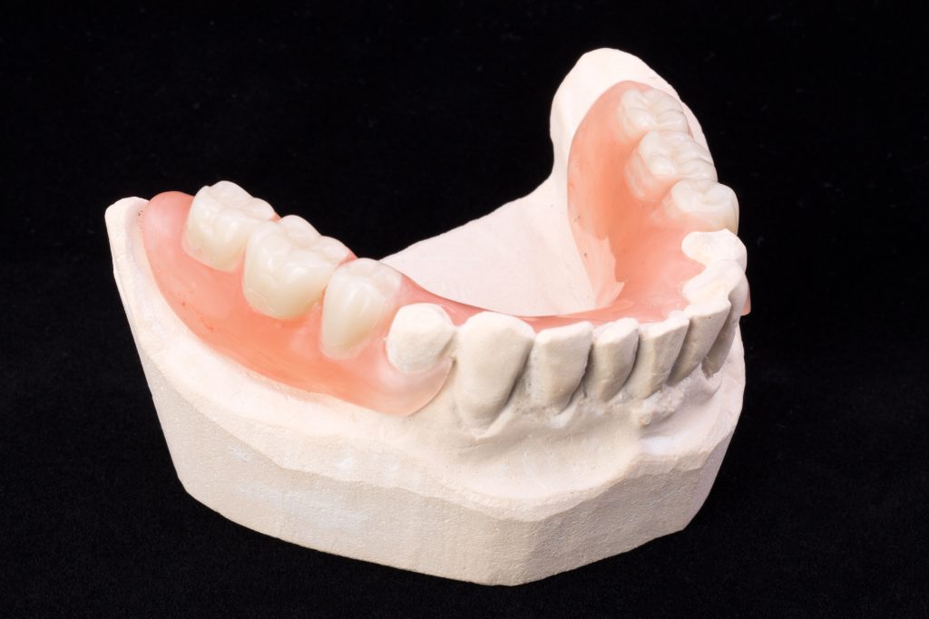 Partial Dentures Silkstone