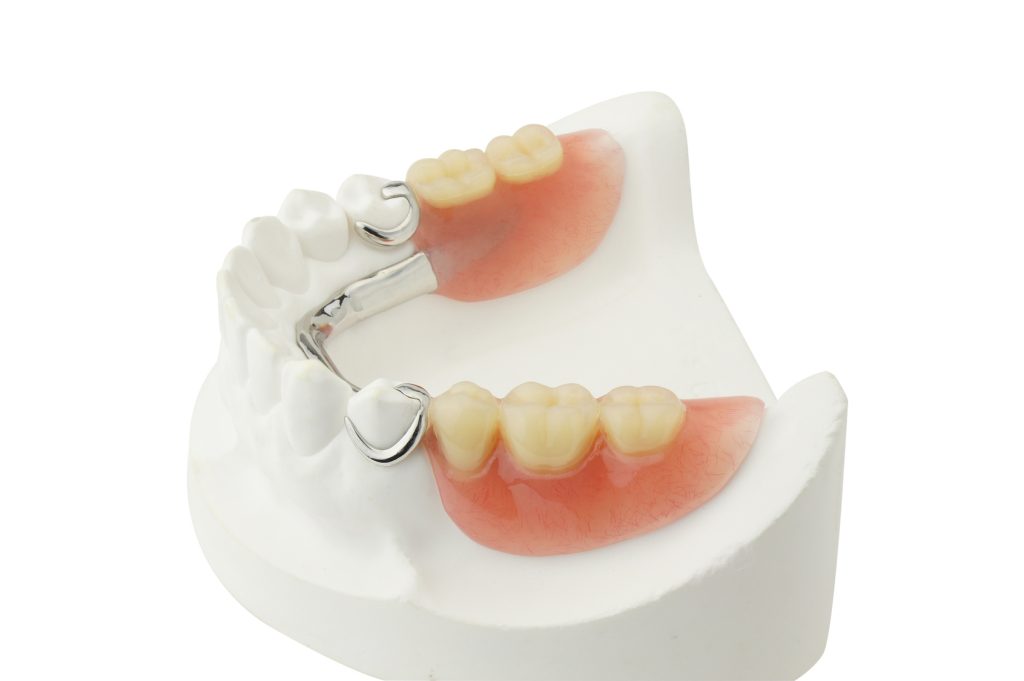 Partial Dentures Silkstone